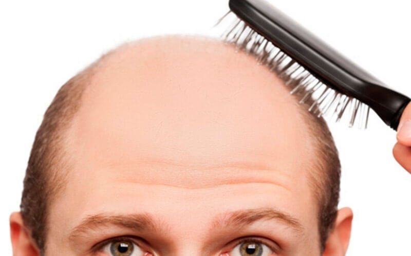 Эзотерические причины выпадения волос у женщин